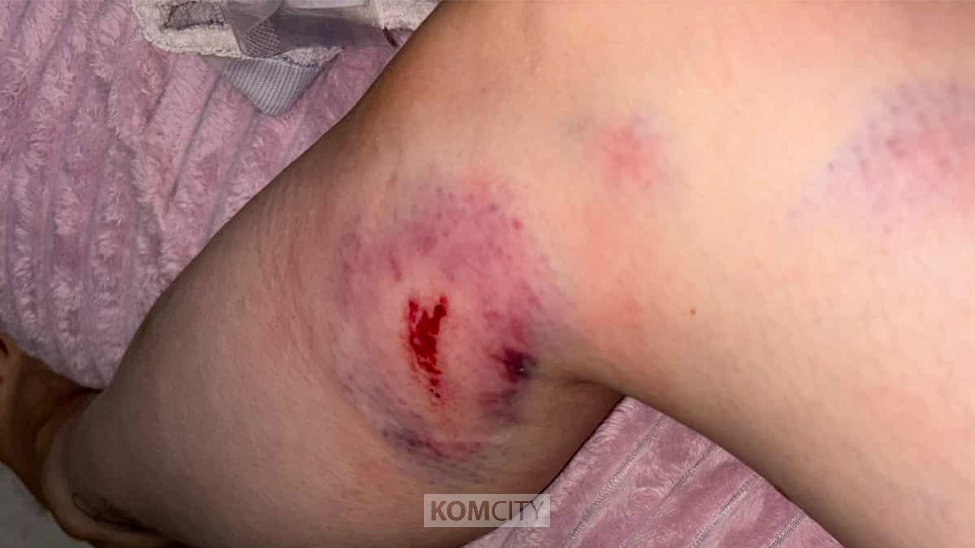 Пацаны на электросамокате сбили девушку на Бульваре Юности